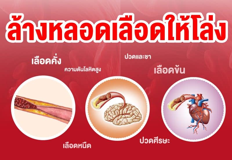 หลอดเลือดหัวใจและสมองตีบ การไหลเวียนเลือดติดขัด รักษาได้ที่ต้นเหตุ