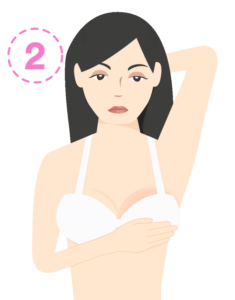 พบก้อนบริเวณเต้านม ลักษณะของก้อนแตกต่างกันไปร่วมกับมีการกดเจ็บ