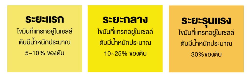 ไขมันพอกตับสามารถแบ่งความรุนแรงออกเป็น 3 ระยะ