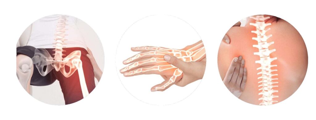 อาการของภาวะกระดูกพรุน