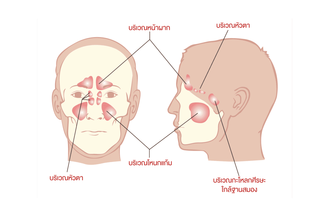 ไซนัสอยู่ตำแหน่งไหน ทำหน้าที่อะไร