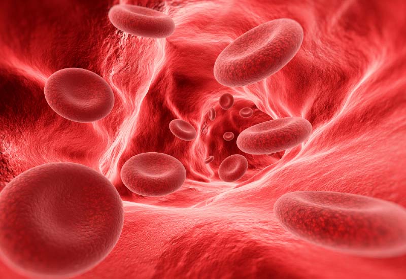 ไขปริศนา ภาวะเลือดคั่ง ล้างระบบหลอดเลือดก่อนจะตัน