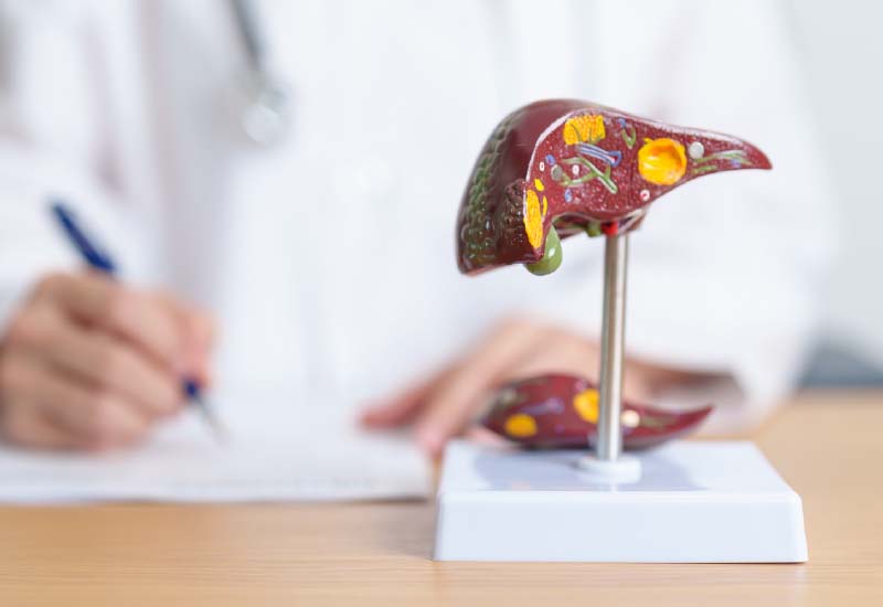 ตับแข็งคืออะไร มีอาการอะไรบ้าง เกิดจากเชื้อไวรัสตับอักเสบได้หรือไม่