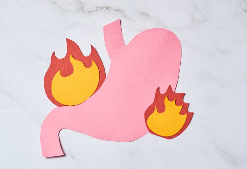 กรดไหลย้อน โรคฮิตของคนเมือง รีบรักษาก่อนเรื้อรัง