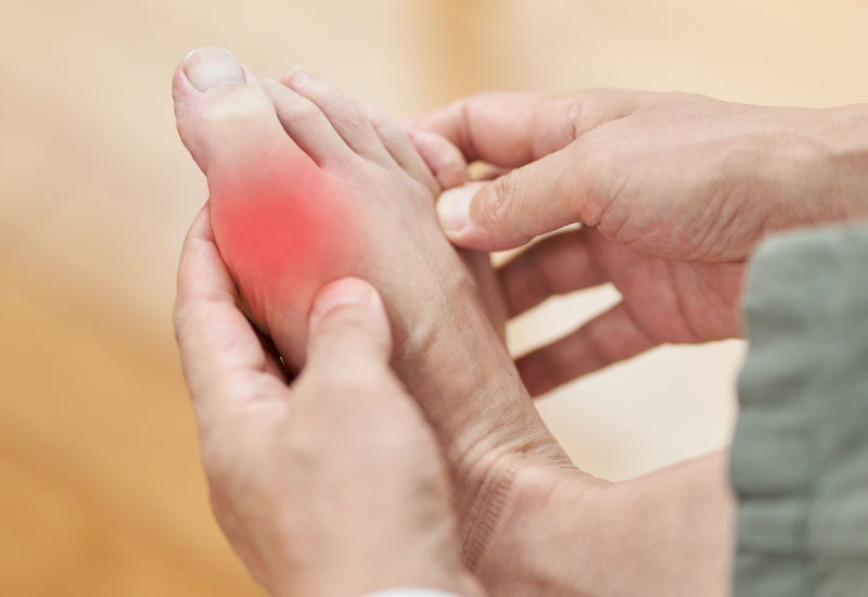 โรคเกาต์เกิดจากอะไร มีวิธีรักษาแบบแพทย์จีนอย่างไร