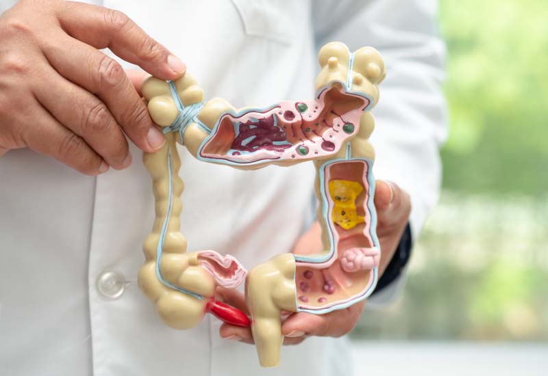 โรคลำไส้แปรปรวน IBS การแพทย์จีนรักษาโดยองค์รวม