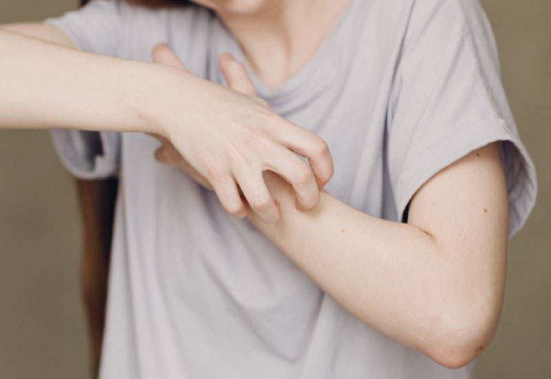 ลมพิษคืออะไร สาเหตุ อาการ และวิธีบำบัดแบบแพทย์จีนคือยังไงบ้าง