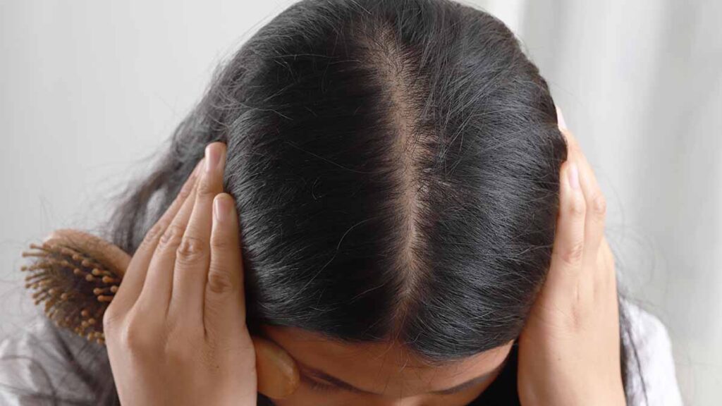 ขาดธาตุเหล็ก เลือดจาง ทำให้ผมร่วงได้หรือไม่ มีวิธีแก้อย่างไร