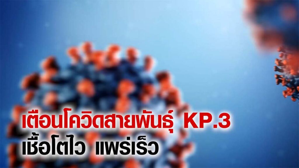 เตือน! โควิดสายพันธุ์ KP.3 เชื้อโตไว แพร่เร็ว