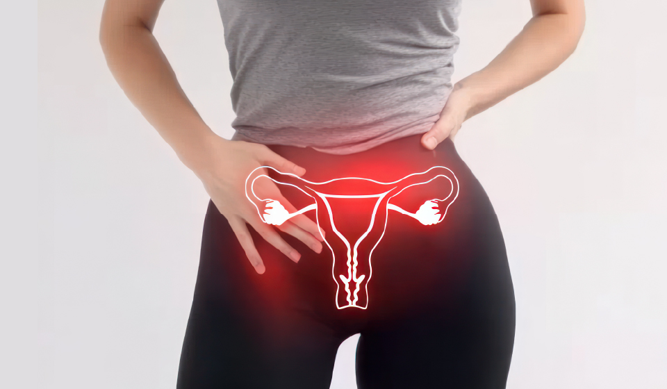 ซีสต์ต์รังไข่ (ถุงน้ำรังไข่) ทางเลือกใหม่จากยาสมุนไพรจีน