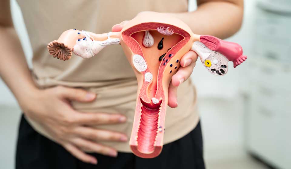 เยื่อบุโพรงมดลูกเจริญผิดที่ ทางเลือกจากยาสมุนไพรจีนในการบรรเทาอาการปวดประจำเดือนและภาวะมีบุตรยาก