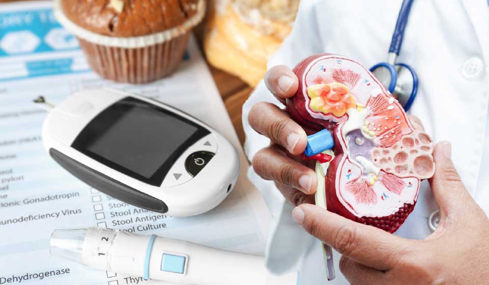 ยาสมุนไพรจีนกับบทบาทในการป้องกันและชะลอโรคไตจากเบาหวาน