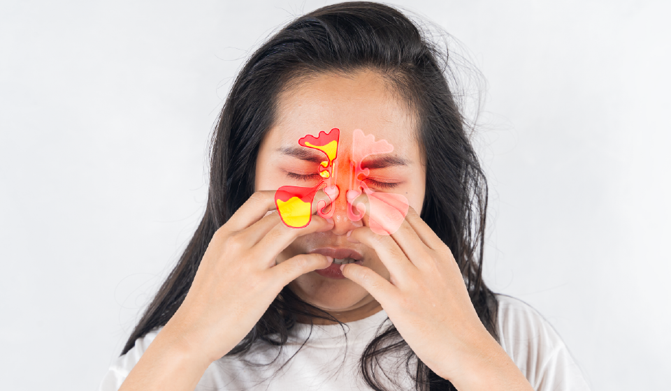 ไซนัสอักเสบเรื้อรัง หยุดวงจรการอักเสบซ้ำ ๆ ด้วยยาสมุนไพรจีน