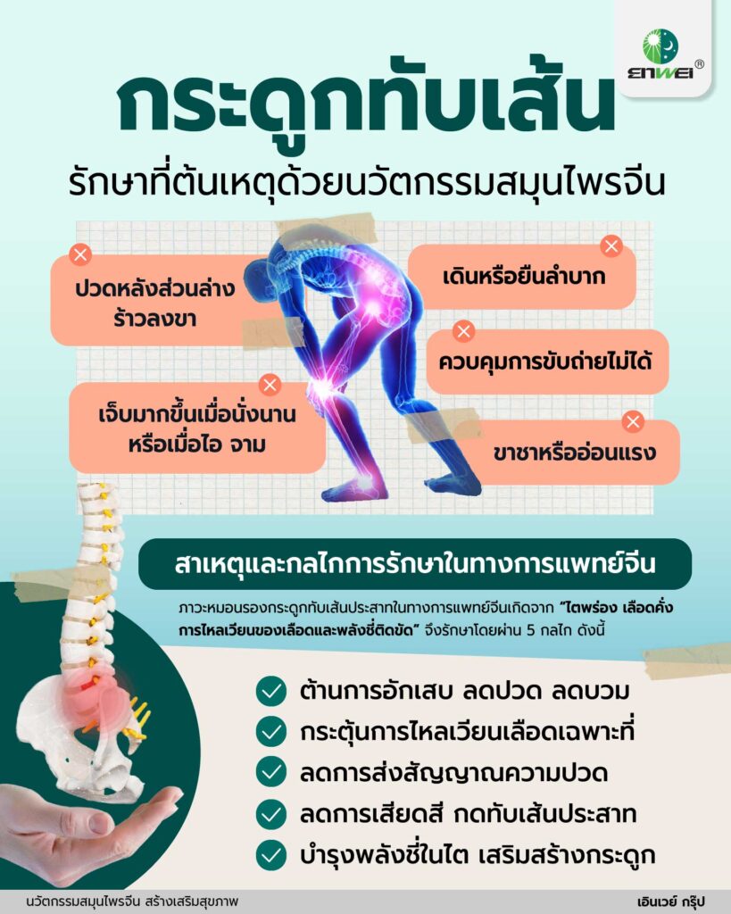 ปวดหลังร้าวลงขา ยาสมุนไพรจีนเป็นทางเลือกใหม่