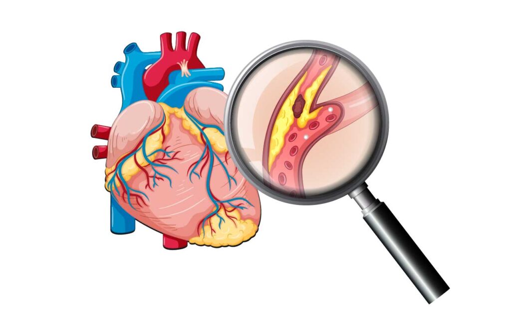 ป้องกันและรักษาหลอดเลือดหัวใจตีบ นวัตกรรมสมุนไพรจีนช่วยคุณได้
